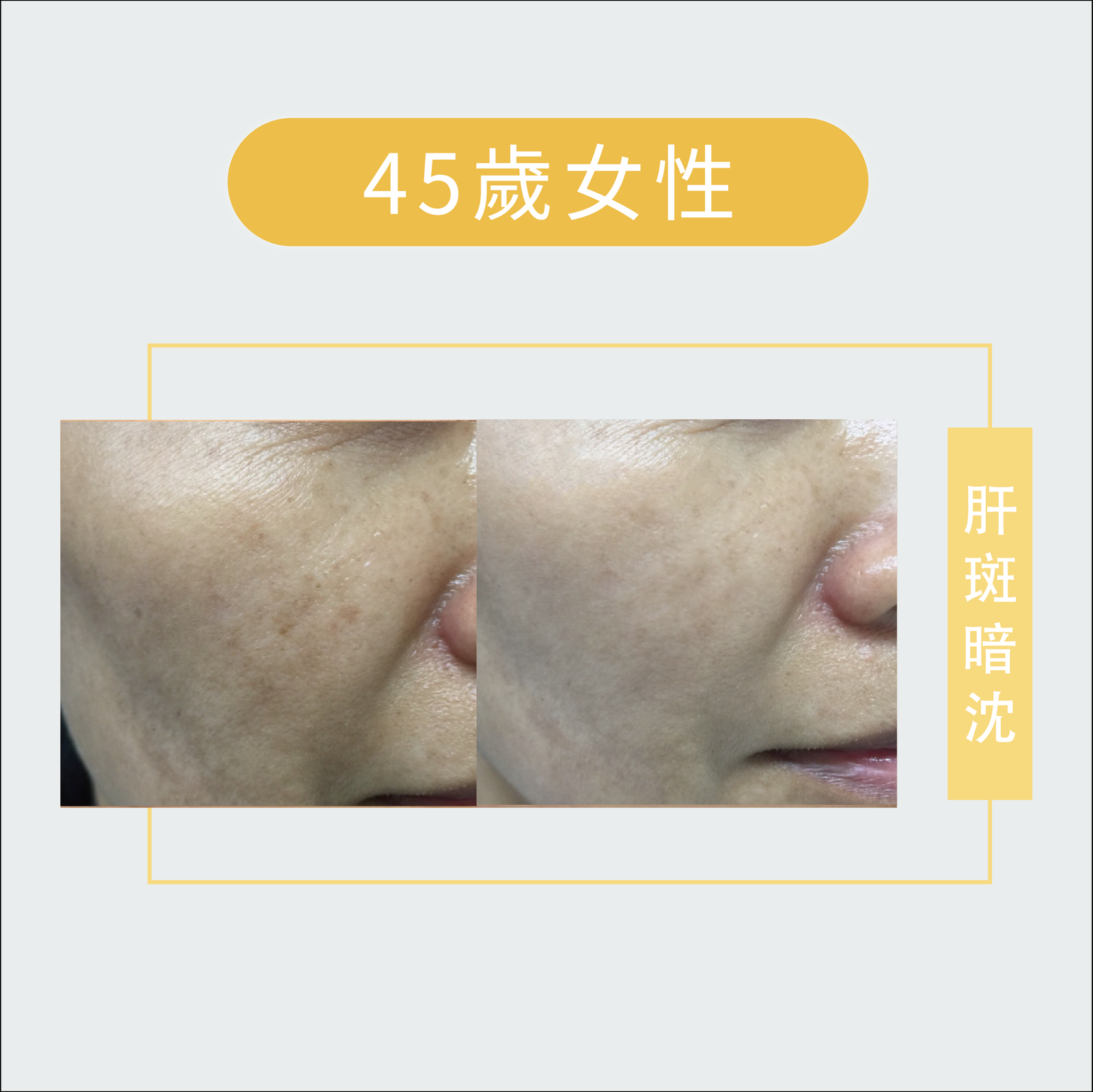 皮膚管理-皮膚問題-02