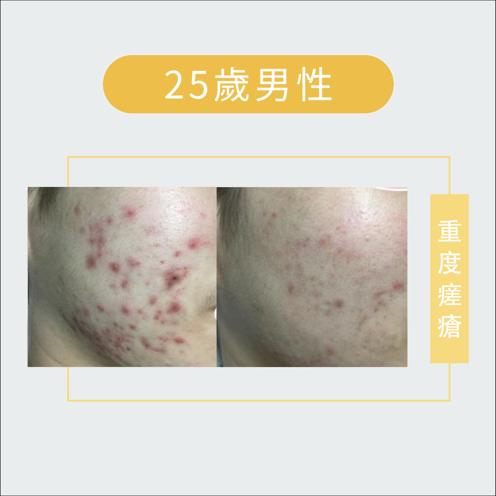 皮膚管理-皮膚問題-03