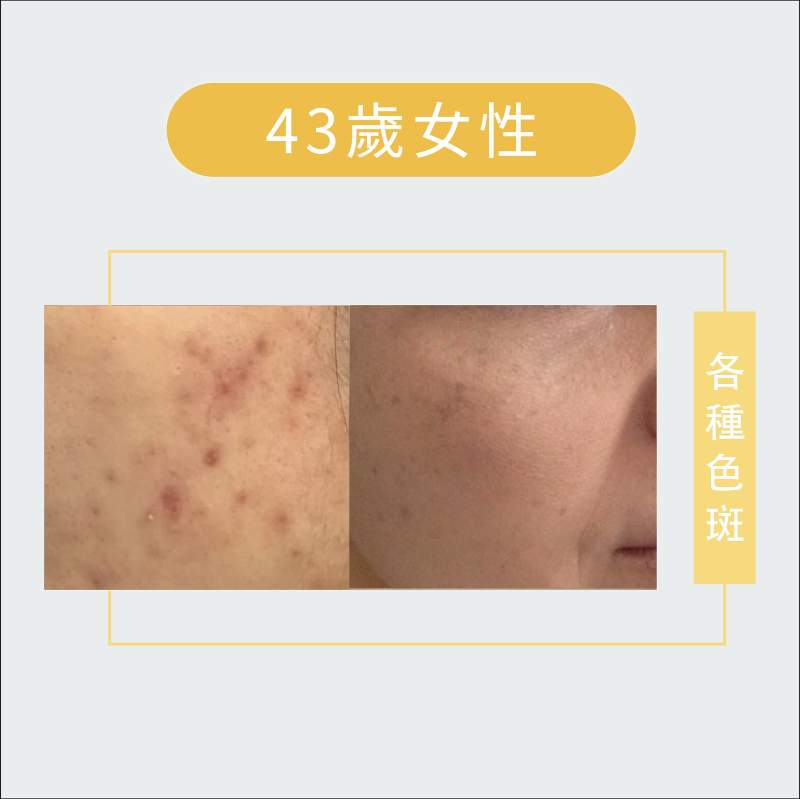 皮膚管理-皮膚問題-04