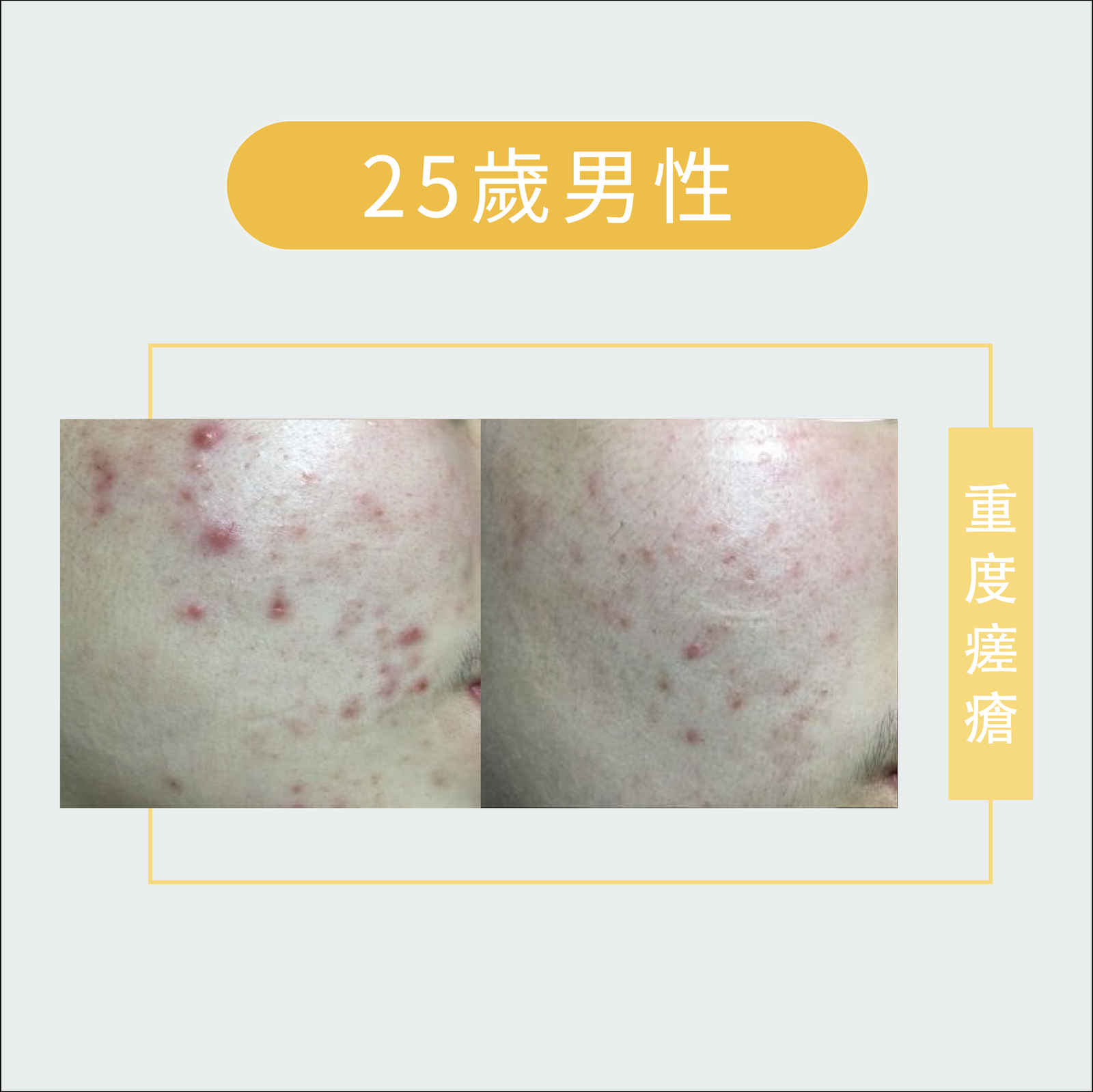 皮膚管理-皮膚問題-06