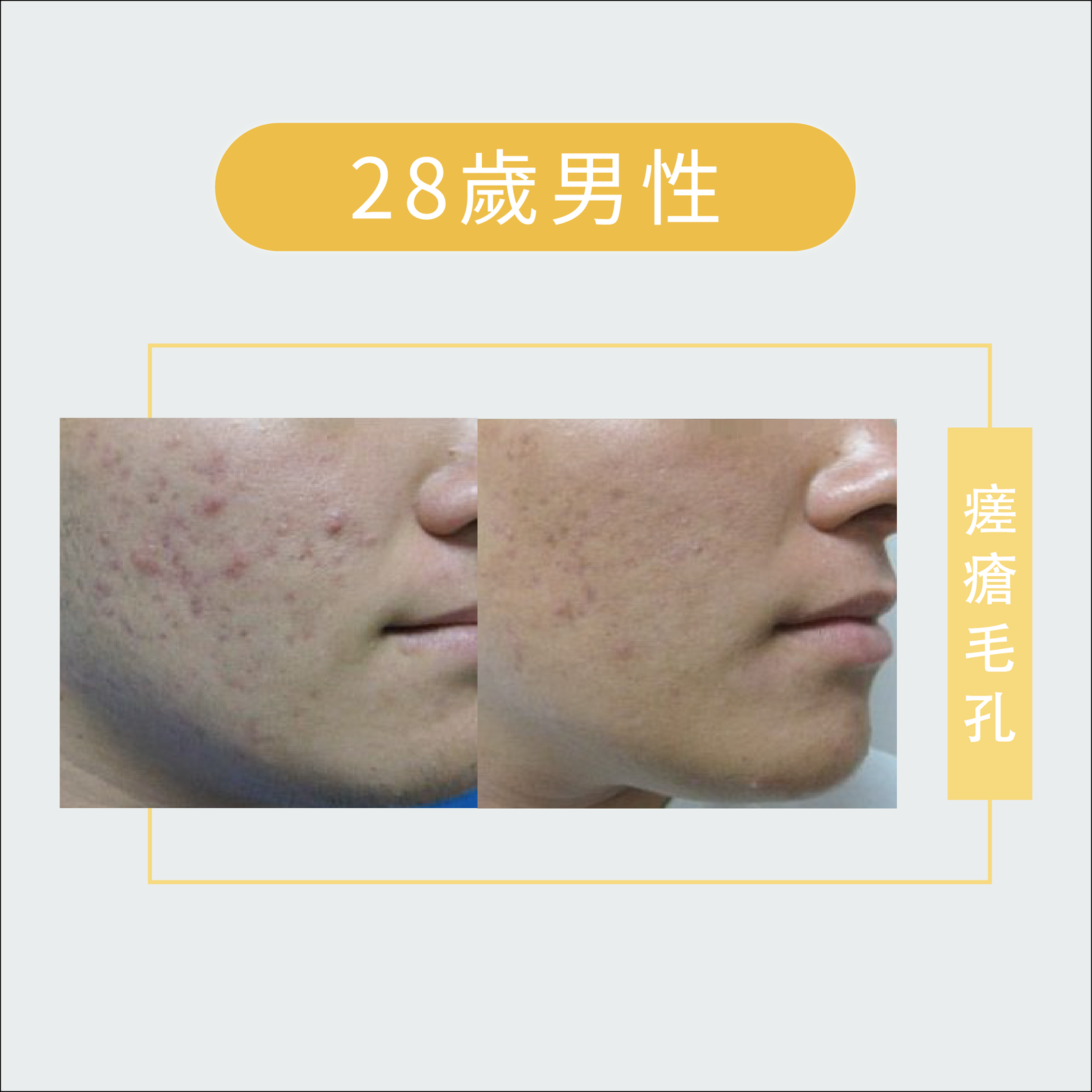 皮膚管理-皮膚問題-07
