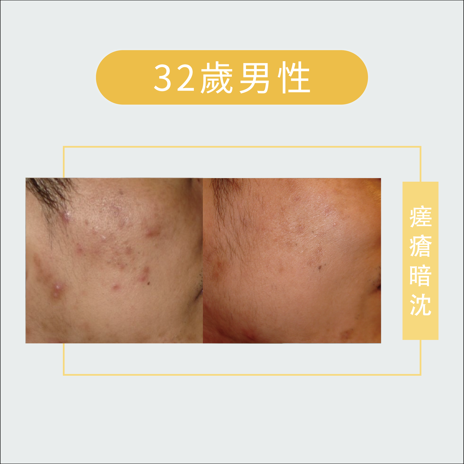 皮膚管理-皮膚問題-08