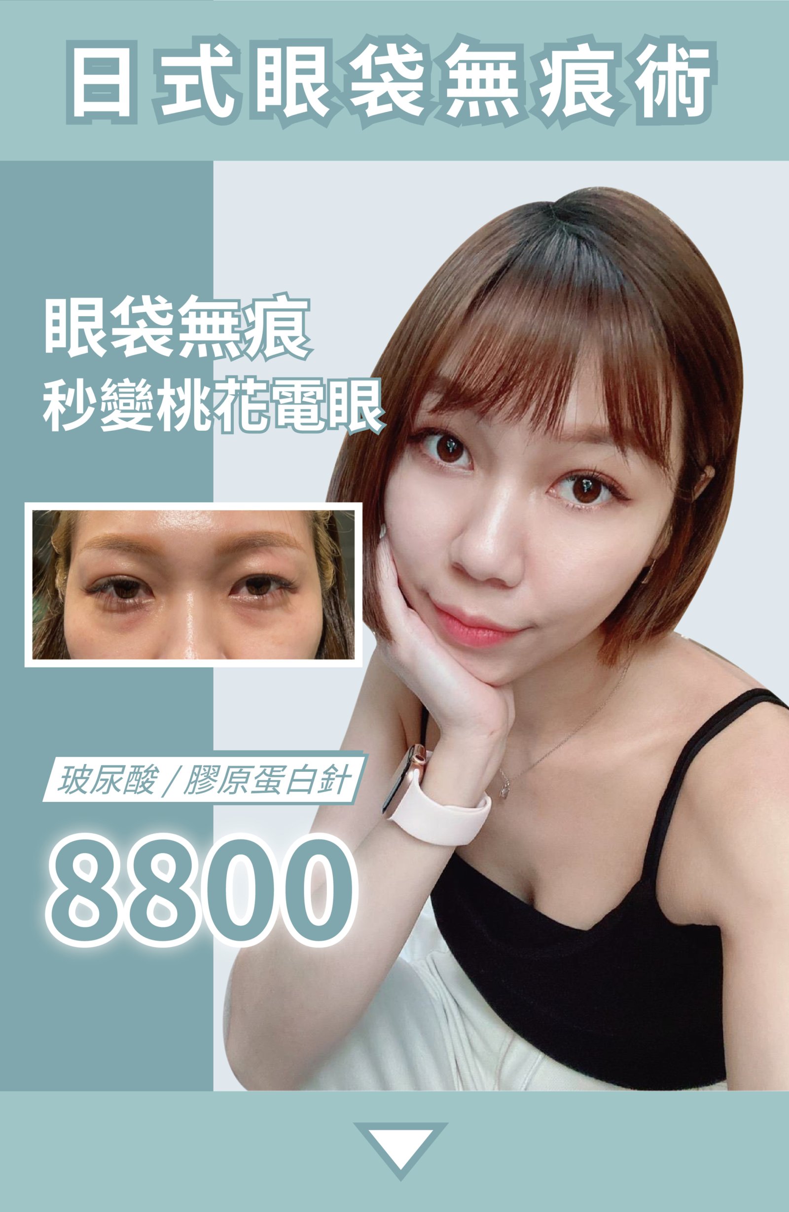 眼袋首圖_首圖