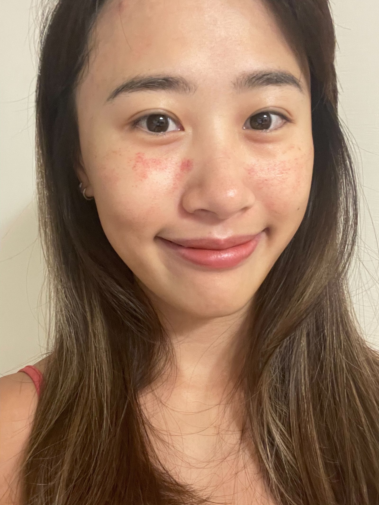 新竹皮秒雷射推薦