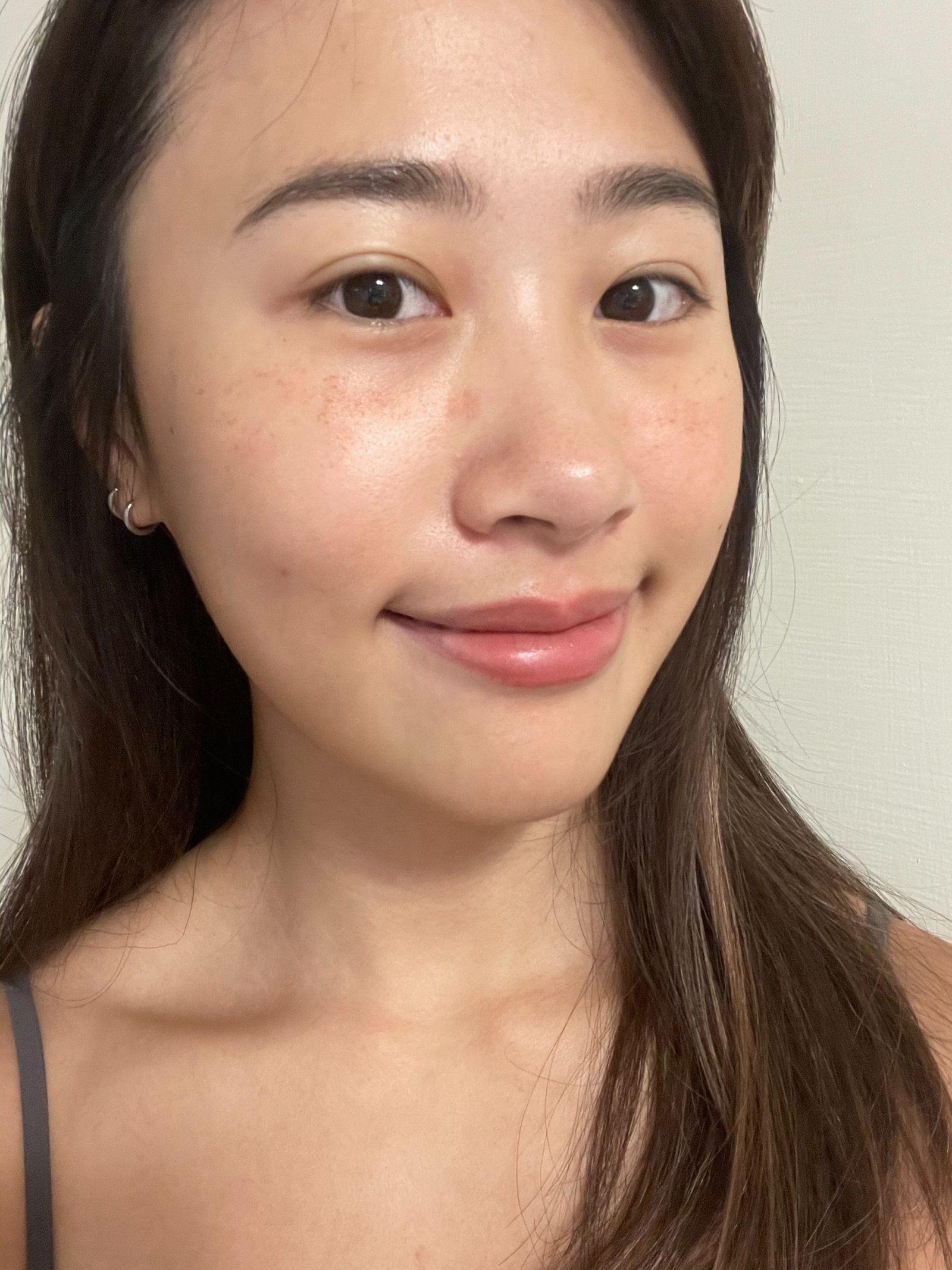 新竹皮秒雷射推薦