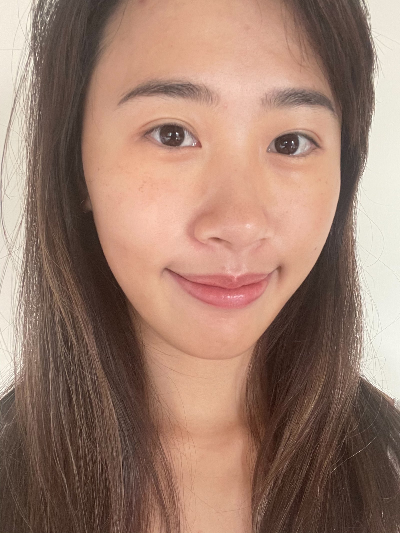 新竹皮秒雷射推薦