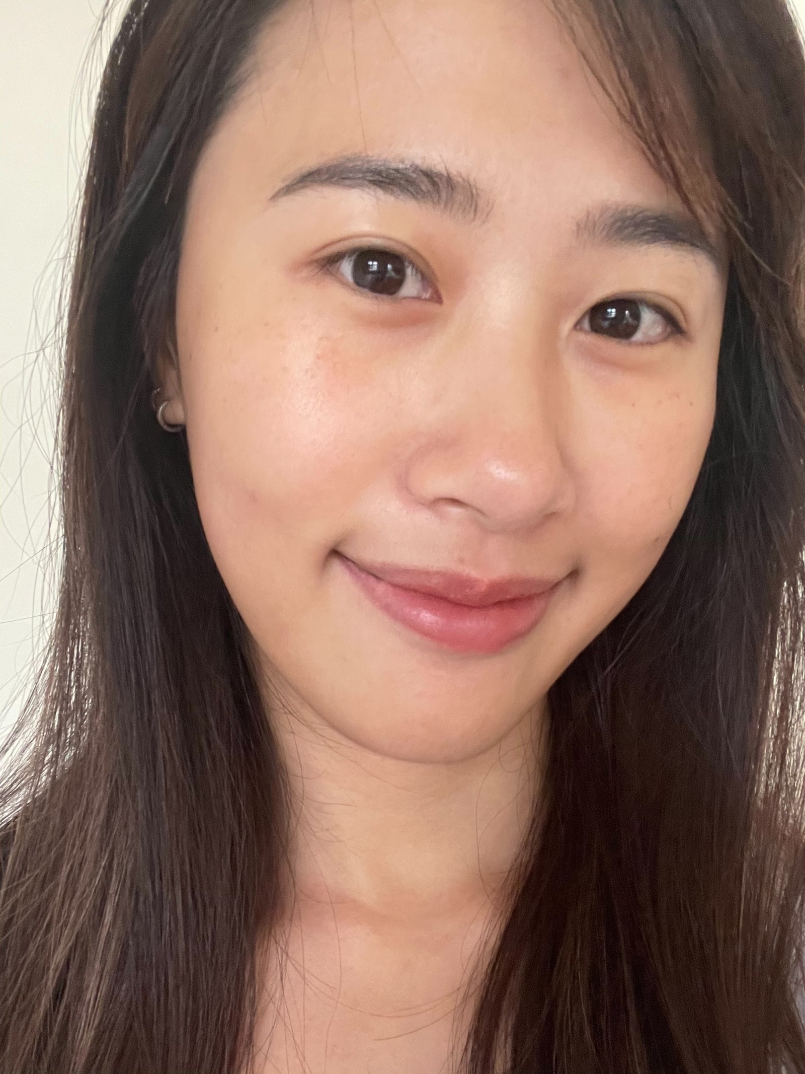 新竹皮秒雷射推薦